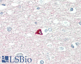 Anti-SNAP25 Antibody (aa151-200) IHC-plus LS-B8391