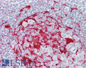 Anti-LRAT Antibody (aa111-160) IHC-plus LS-B8398