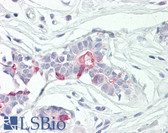 Anti-TNFAIP8 / SCC-S2 Antibody (aa31-80) IHC-plus LS-B8399
