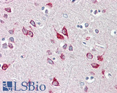 Anti-HEXB Antibody (aa481-530) IHC-plus LS-B8401