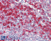 Anti-D52 / TPD52 Antibody (aa41-90) IHC-plus LS-B8407