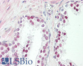 Anti-HMGXB3 Antibody (aa131-180) IHC-plus LS-B8408