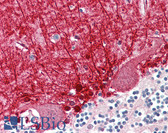 Anti-MED21 Antibody (aa71-120) IHC-plus LS-B8410