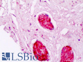 Anti-CRYAB / Alpha B Crystallin Antibody IHC-plus LS-B8412