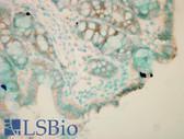 Anti-CANX / Calnexin Antibody (N-Terminus) IHC-plus LS-B8413