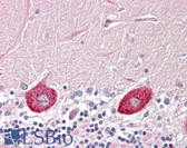 Anti-DGKZ Antibody (aa601-650) IHC-plus LS-B8416