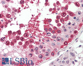 Anti-TSN / Translin Antibody (aa101-150) IHC-plus LS-B8418