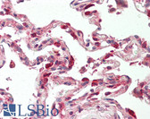 Anti-TSC22D1 / TSC22 Antibody (aa71-120) IHC-plus LS-B8419