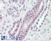 Anti-VPS72 Antibody (aa131-180) IHC-plus LS-B8421