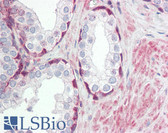 Anti-TRIM59 Antibody (aa191-240) IHC-plus LS-B8422