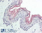 Anti-PPHLN1 Antibody (aa71-120) IHC-plus LS-B8424