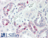 Anti-JAKMIP2 Antibody (aa761-810) IHC-plus LS-B8428