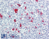 Anti-BTBD6 Antibody (aa91-140) IHC-plus LS-B8429