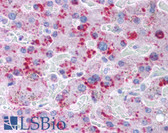 Anti-MLXIPL / CHREBP Antibody (aa50-150) IHC-plus LS-B254