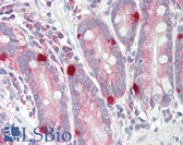 Anti-TRERF1 Antibody (aa1071-1120) IHC-plus LS-B8430