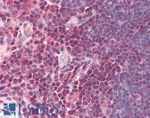Anti-TRADD Antibody IHC-plus LS-B8432