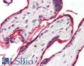 Anti-SDC1 / Syndecan 1 / CD138 Antibody IHC-plus LS-B8436
