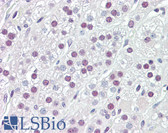 Anti-HSF1 Antibody IHC-plus LS-B8437