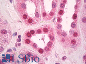 Anti-SMARCA4 / BRG1 Antibody (aa75-125) IHC-plus LS-B8447