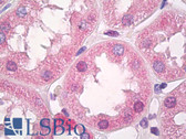 Anti-PFKP Antibody (C-Terminus) IHC-plus LS-B8456
