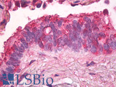 Anti-ANXA2 / Annexin A2 Antibody (N-Terminus) IHC-plus LS-B8457