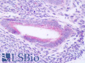 Anti-PLCZ1 Antibody (Internal) IHC-plus LS-B8469
