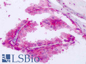 Anti-PABPC1 / PABP1 Antibody (Internal) IHC-plus LS-B8470