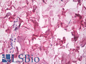 Anti-COL5A1 / Collagen V Alpha 1 Antibody (clone 6A7) IHC-plus LS-B8472