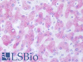 Anti-ABCC6 / MRP6 Antibody (Internal, clone EPR8342) IHC-plus LS-B8479