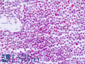 Anti-PABPN1 / PABP2 Antibody (Internal, clone EP3001Y) IHC-plus LS-B8482
