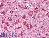 Anti-NEI3 / NEIL3 Antibody (aa164-177) IHC-plus LS-B259