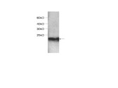 Anti-SOD1 / SOD Antibody IHC-plus LS-B8489