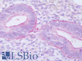 Anti-MUC16 / CA125 Antibody IHC-plus LS-B8491