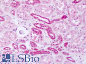 Anti-PPIA / Cyclophilin A Antibody (Internal, clone EPR7511) IHC-plus LS-B8495