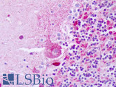 Anti-TNFRSF10B / Killer / DR5 Antibody IHC-plus LS-B8498