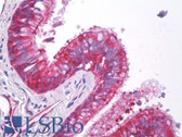 Anti-HSPB1 / HSP27 Antibody (clone G3.1) IHC-plus LS-B8503