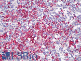 Anti-SLC2A1 / GLUT-1 Antibody (clone SPM498) IHC-plus LS-B8505