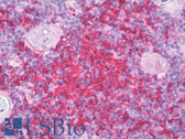 Anti-FSCN1 / Fascin Antibody (clone FCN01) IHC-plus LS-B8510