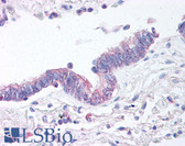 Anti-PAWR Antibody (N-Terminus) IHC-plus LS-B267