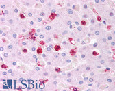 Anti-CCR5 Antibody IHC-plus LS-B275
