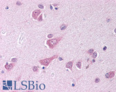 Anti-CLOCK Antibody IHC-plus LS-B278