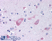 Anti-GABARAP Antibody (N-Terminus) IHC-plus LS-B283