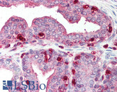 Anti-PFN1 / Profilin 1 Antibody IHC-plus LS-B292