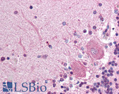 Anti-PLTP Antibody IHC-plus LS-B295