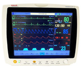 Tranquility II Multiparameter Patient Monitor 12.1in Touchscreen