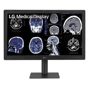 LG 32HQ713D-B 31.5-inch 8MP Diagnostic Radiology Display