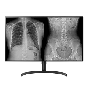 LG 32HL512D-B 31.5 inch 8MP Color Radiology Diagnostic Display