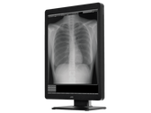 JVC MS-300 21.3" Radiology Monitor