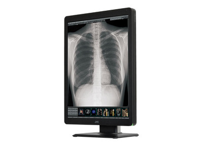 JVC CL-S300 21.3" Radiology Monitor