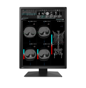 Eizo MX 217 2MP 21" Radiology Monitor